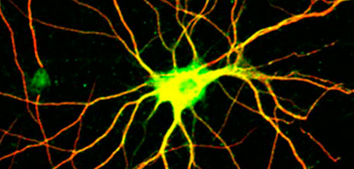 cerebro1