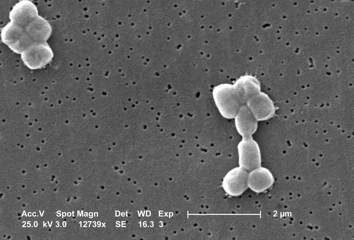 bacteria